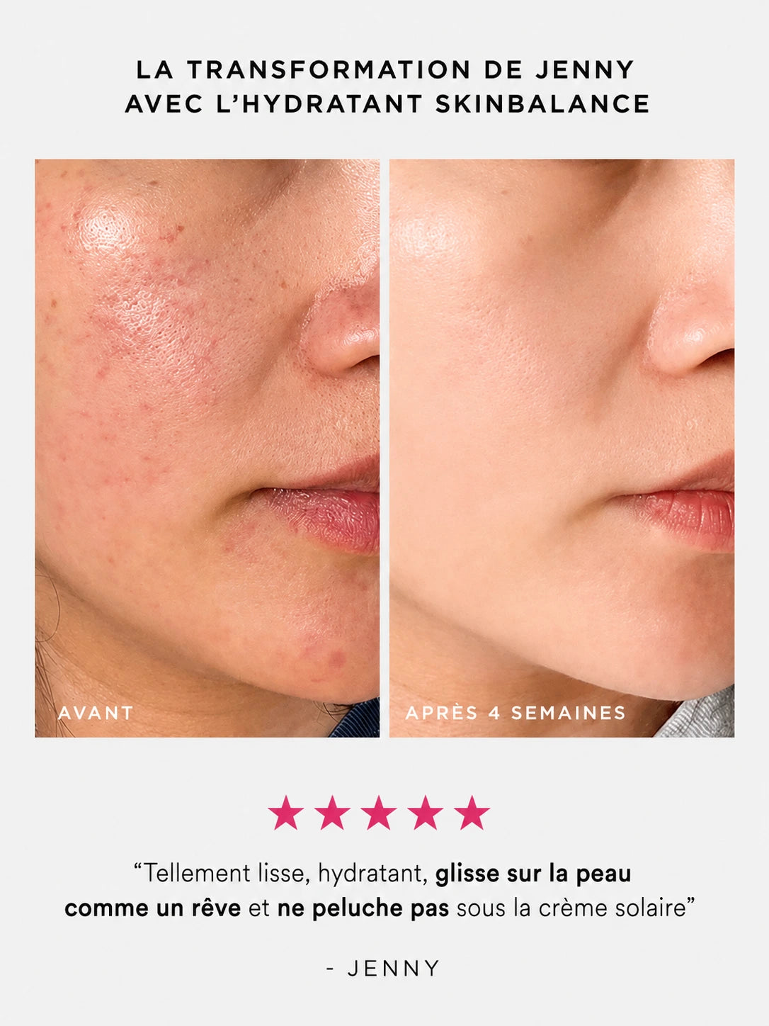 Hydratant SkinBalance