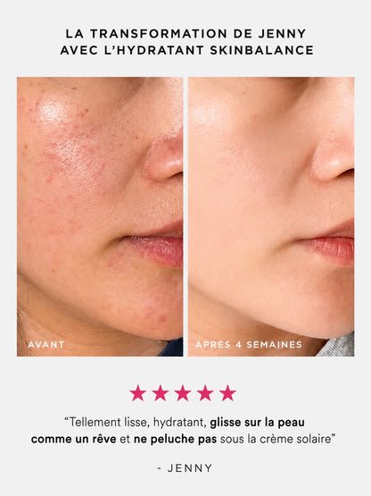Hydratant SkinBalance