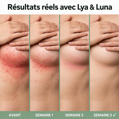 Lya & Luna – Crème Apaisante contre l’Intertrigo