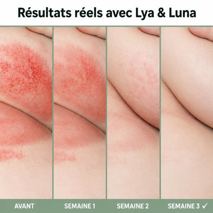 Lya & Luna – Crème Apaisante contre l’Intertrigo