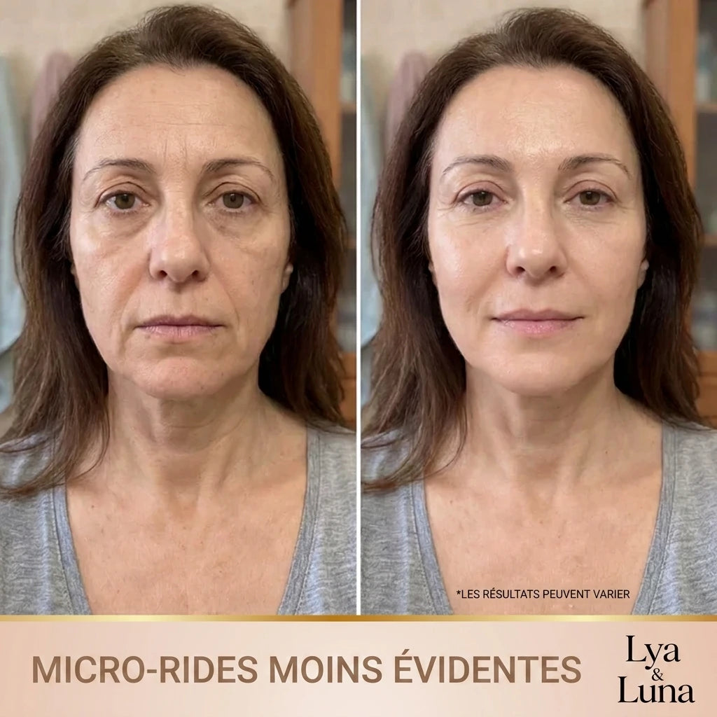 Lya & Luna – Sérum Coréen Effet Lifting dès la Première Application